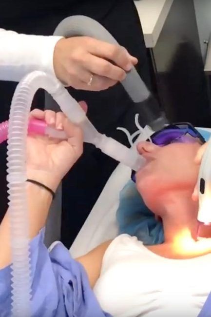 Woman undergoing nitrous oxide sedation